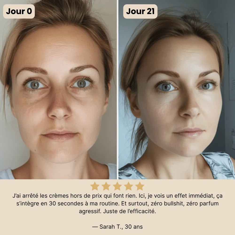 Patchs anti-cernes Noora - Noora