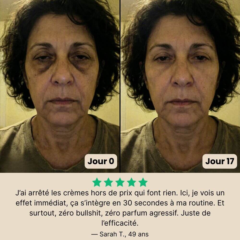 Patchs Jeunesse du Regard Noora - Noora