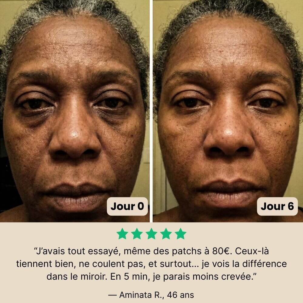 Patchs Jeunesse du Regard Noora - Noora