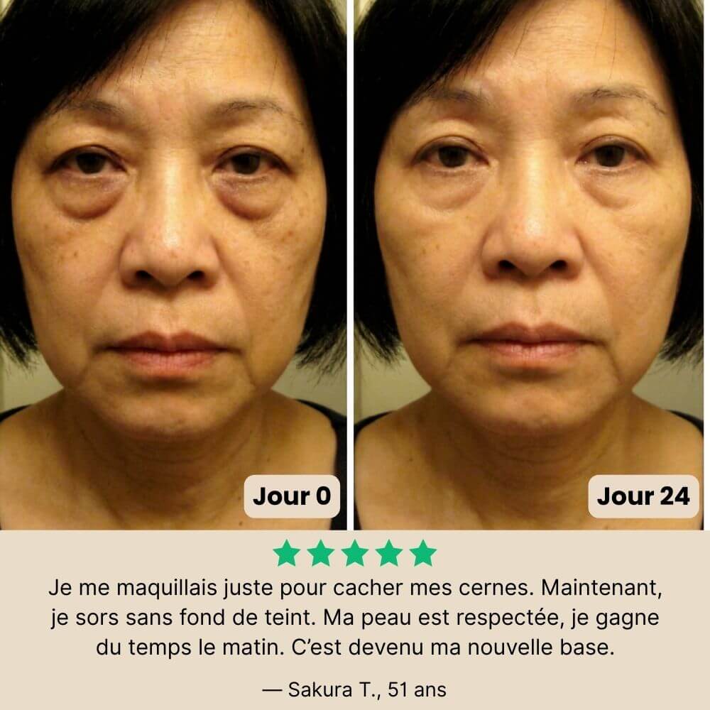 Patchs Jeunesse du Regard Noora - Noora