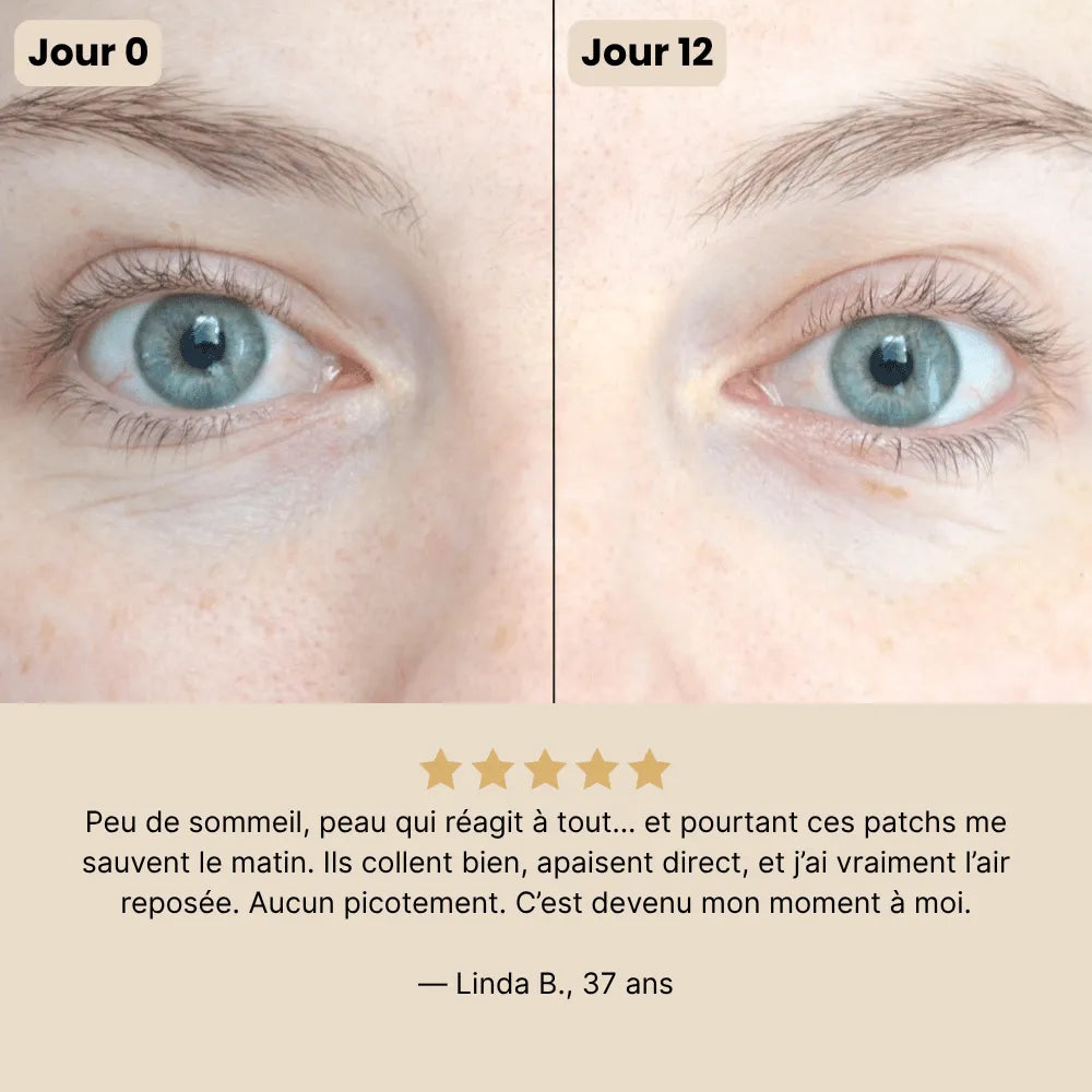 Patchs anti-cernes Noora - Noora